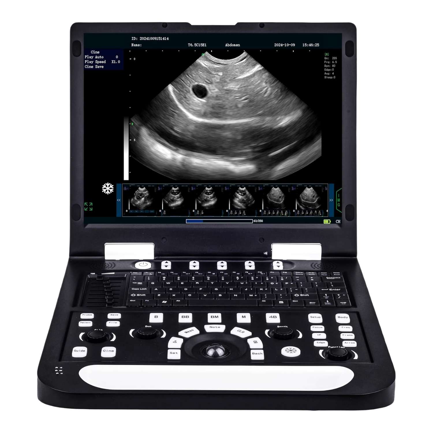 Ecógrafo veterinario N60 basado en PC con pantalla de 15 pulgadas para uso clínico.