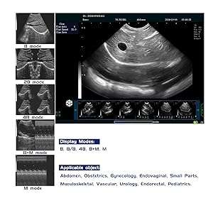 Ecógrafo veterinario N60 basado en PC con pantalla de 15 pulgadas para uso clínico.