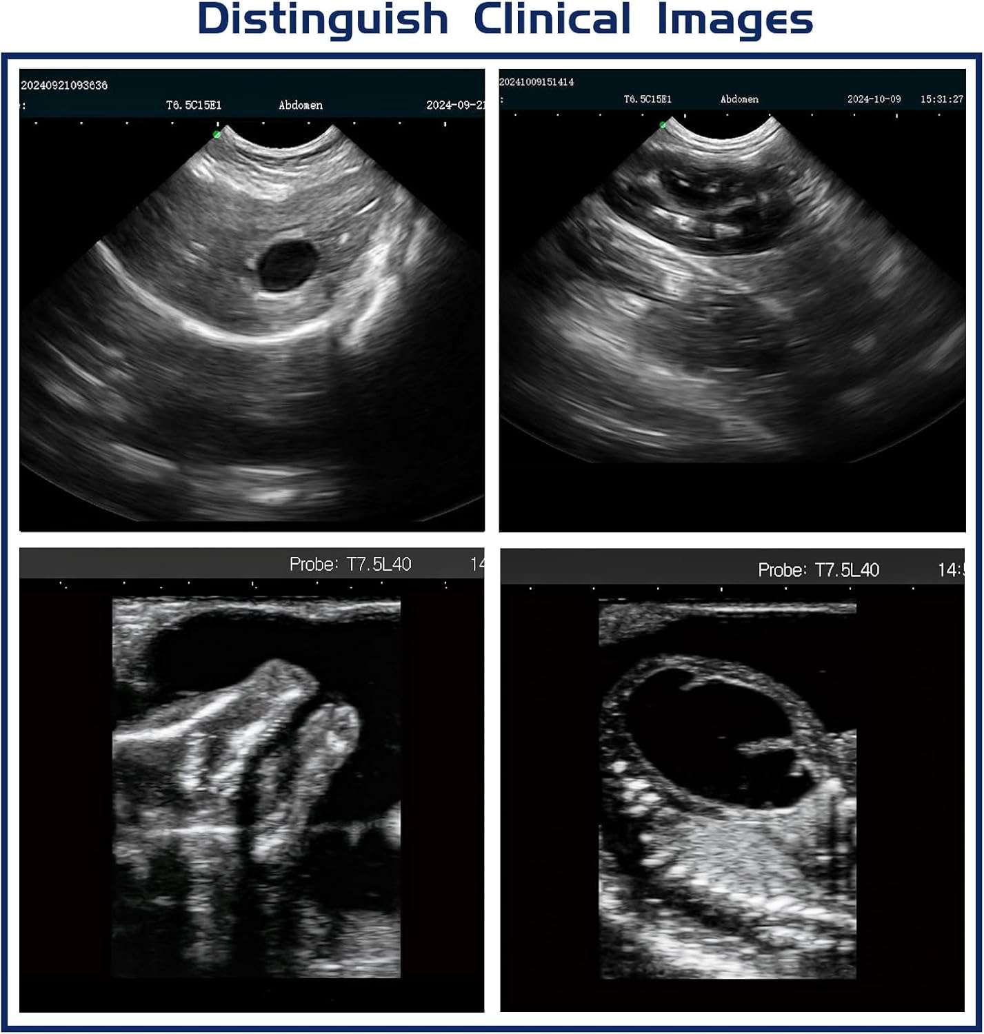 Ecógrafo veterinario N60 basado en PC con pantalla de 15 pulgadas para uso clínico.