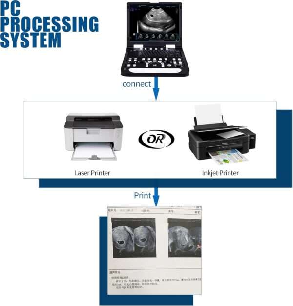Ecógrafo veterinario N60 basado en PC con pantalla de 15 pulgadas para uso clínico.