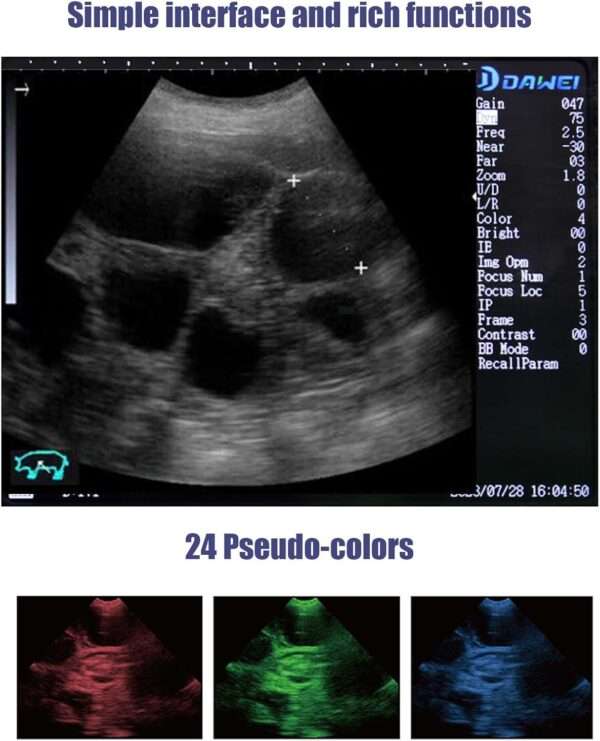Ecógrafo veterinario portátil S1 con sonda convexa 3.5 MHz para diagnóstico en ganado y caballos.