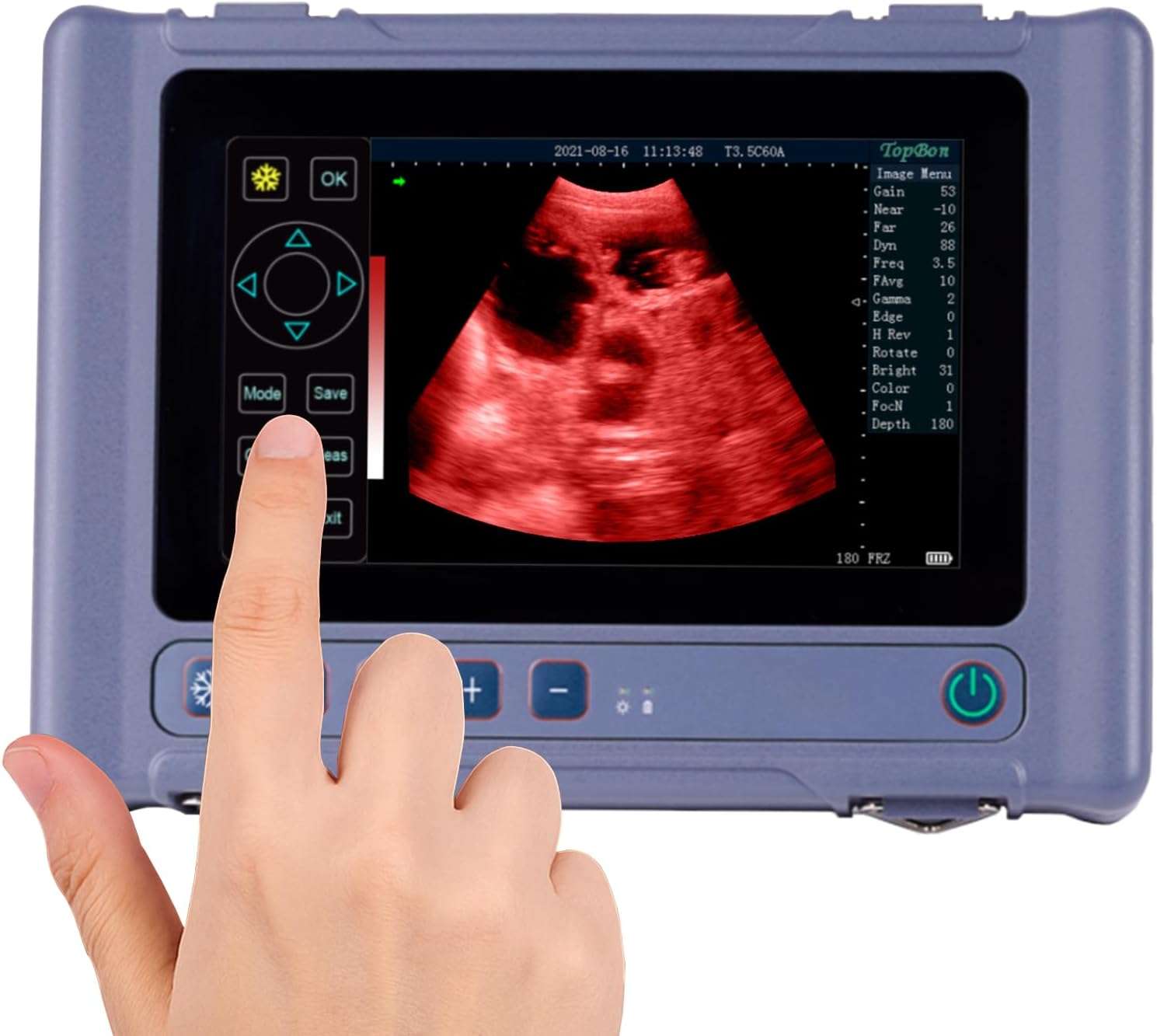 Ecógrafo veterinario portátil T1 con pantalla táctil y sondas dobles.