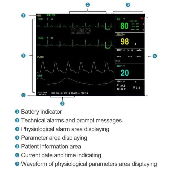 Monitor de paciente veterinario multiparamétrico para clínicas y uso casero. Mide ETCO2, presión arterial, SpO2 y otros parámetros en perros y gatos.