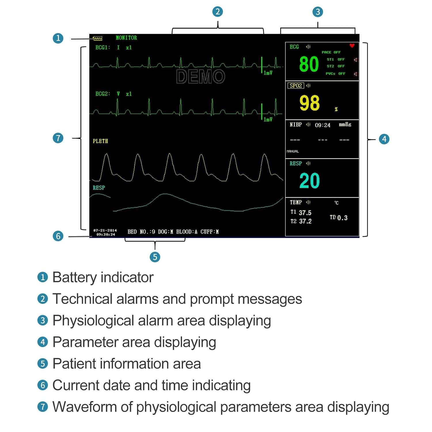 Monitor de paciente veterinario multiparamétrico para clínicas y uso casero. Mide ETCO2, presión arterial, SpO2 y otros parámetros en perros y gatos.