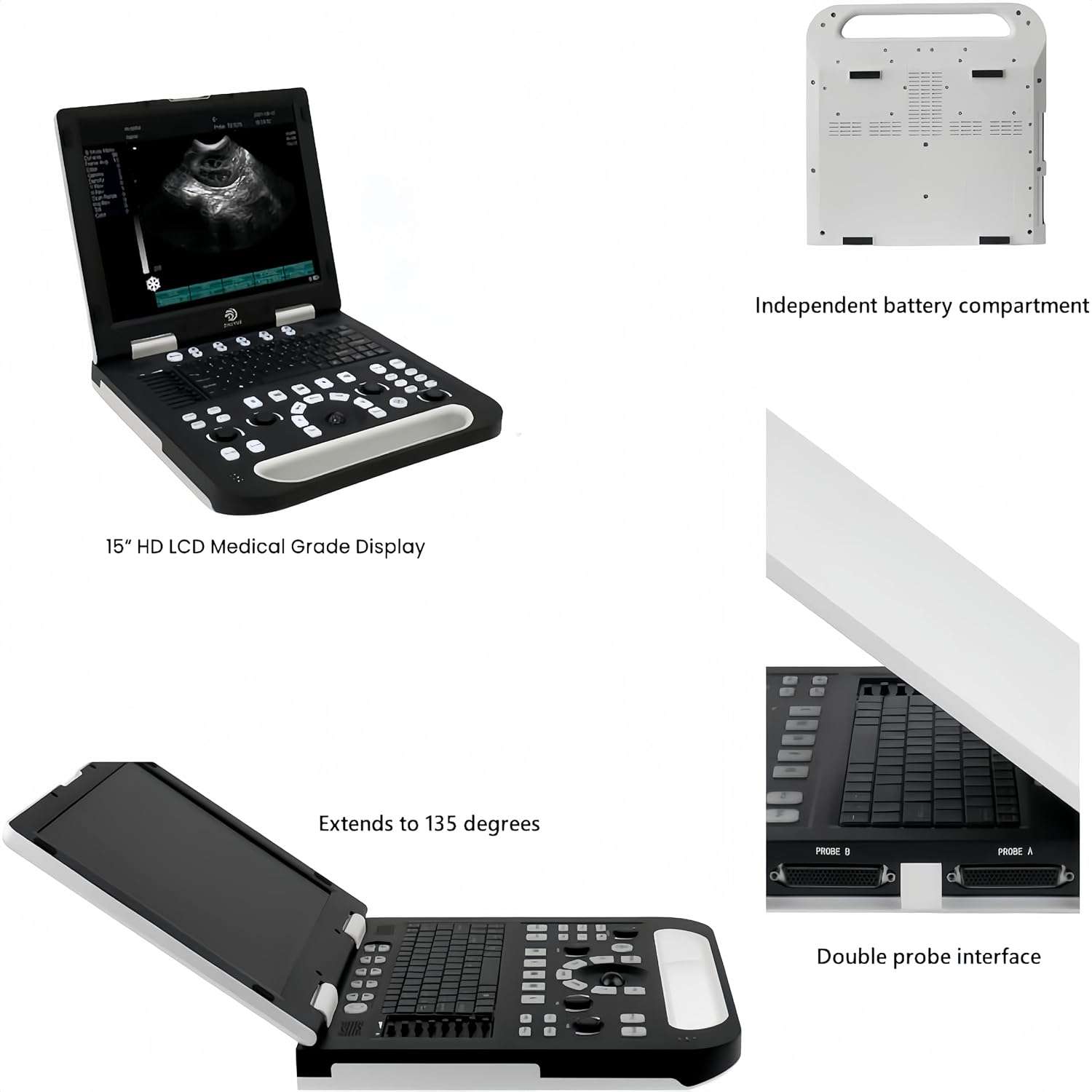 Ecografo veterinario portatil HD con opciones de sondas compatibles para el diagnostico animal.