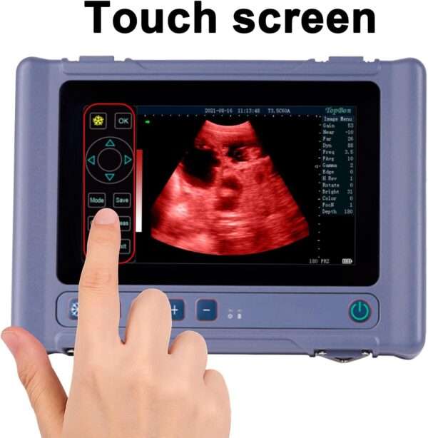 Ecógrafo Veterinario Portátil Táctil 8" HD. Incluye Sonda Convexa 3.5 MHz. 8 Horas de Batería para Diagnóstico Multiespecie.