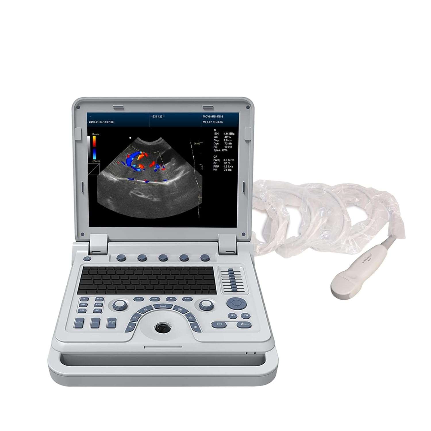 Ecografo doppler color portatil tipo laptop compatible con multiples sondas para uso veterinario.