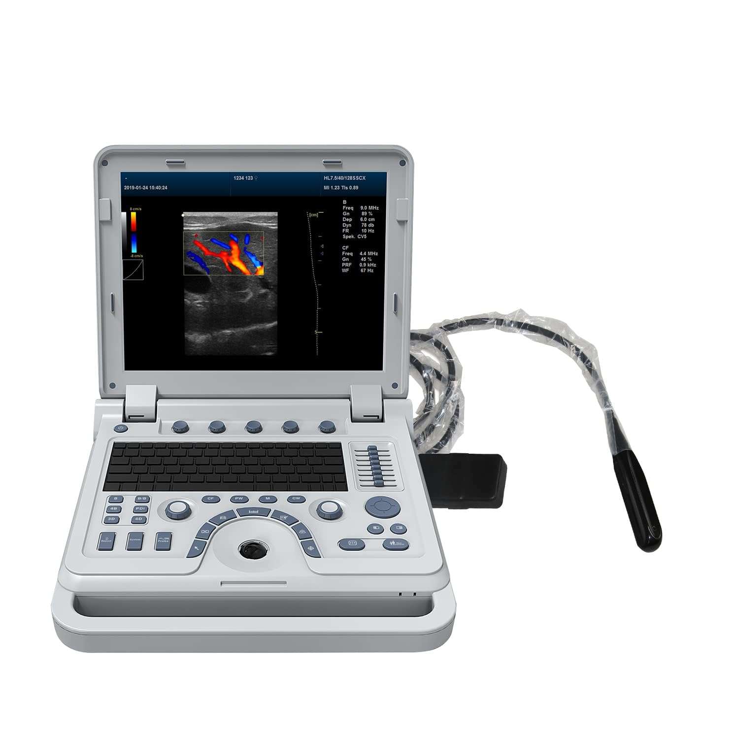 Ecografo doppler color veterinario portatil 15 pulgadas laptop sondas intercambiables perros ganado exóticos