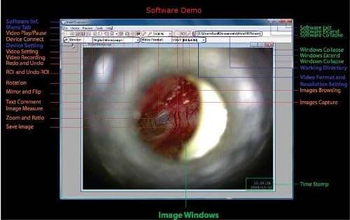 Otoscopio de video digital veterinario inalambrico con conexion a pc para examenes de oidos y piel.