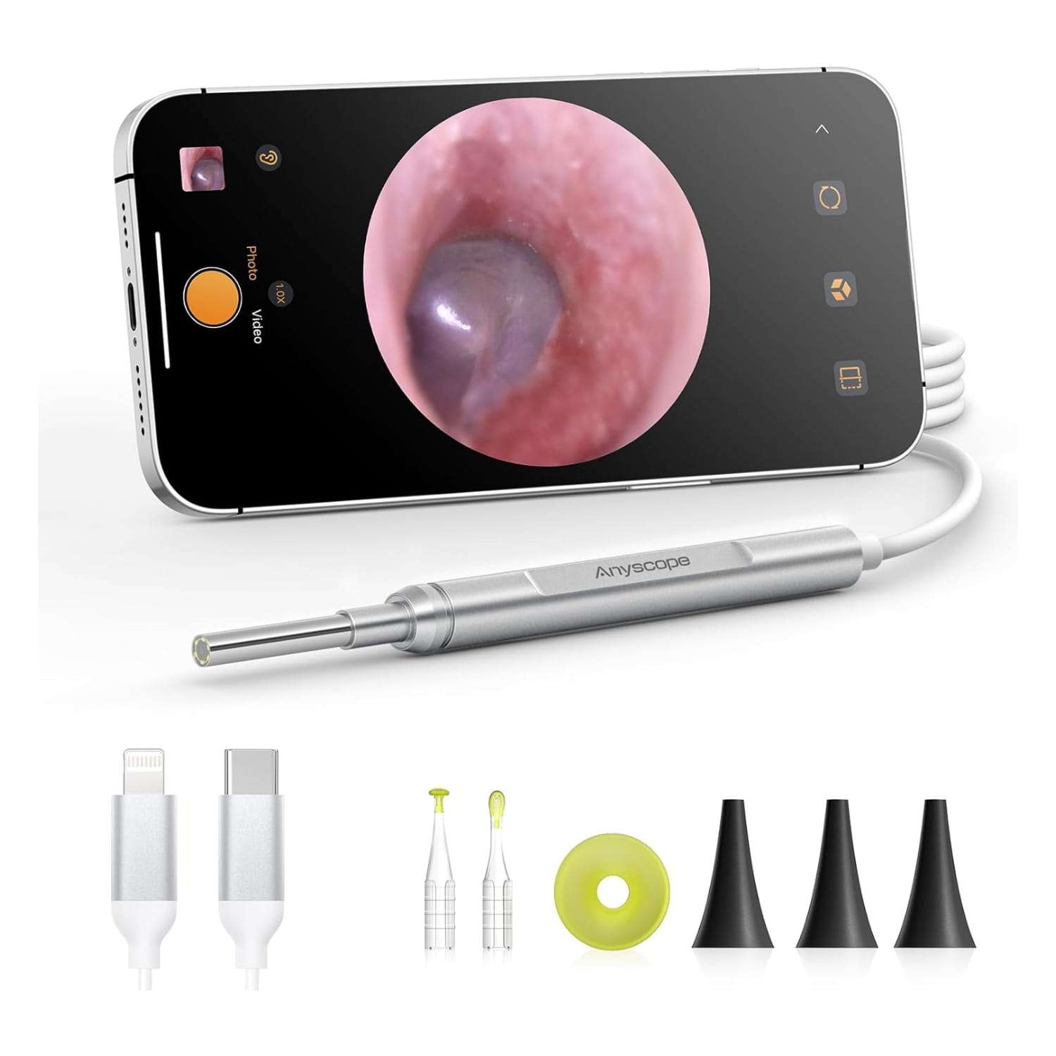 Otoscopio digital veterinario con camara para inspeccion de oidos en perros y gatos compatible con celular
